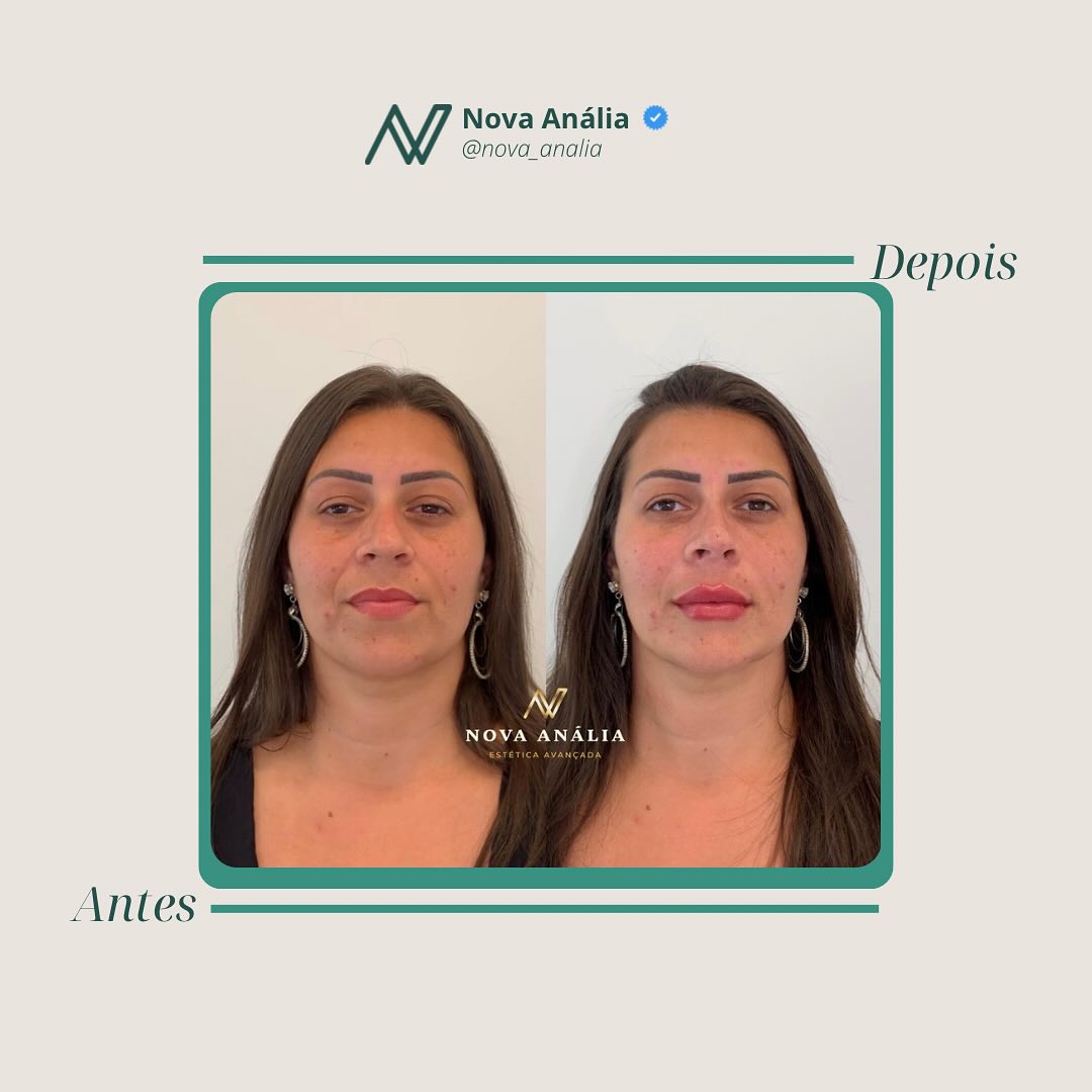 Antes e depois — Planejamento Personalizado